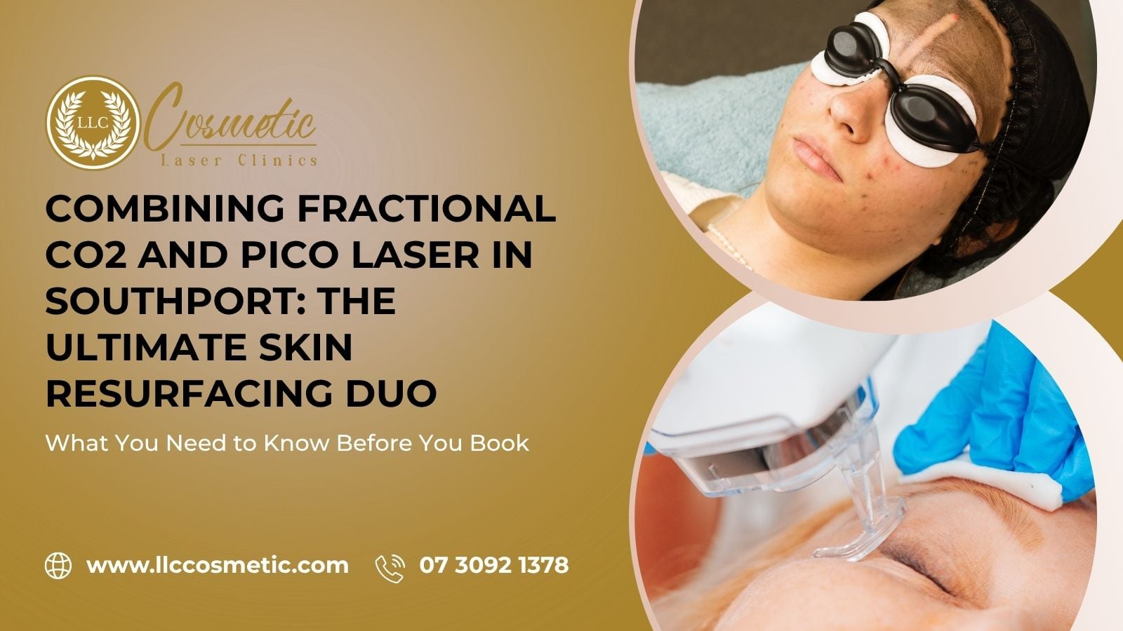 Combining Fractional CO2 and Pico Laser, Southport, Ultimate Skin Resurfacing Duo
