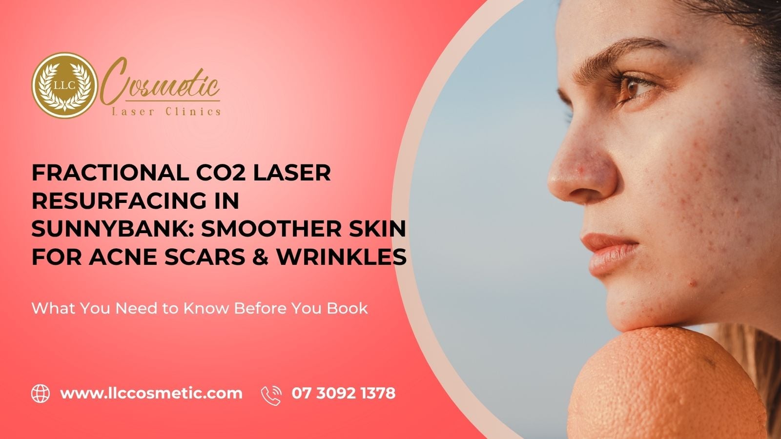 Fractional CO2 Laser Resurfacing, Sunnybank, Smoother Skin, Acne Scars & Wrinkles