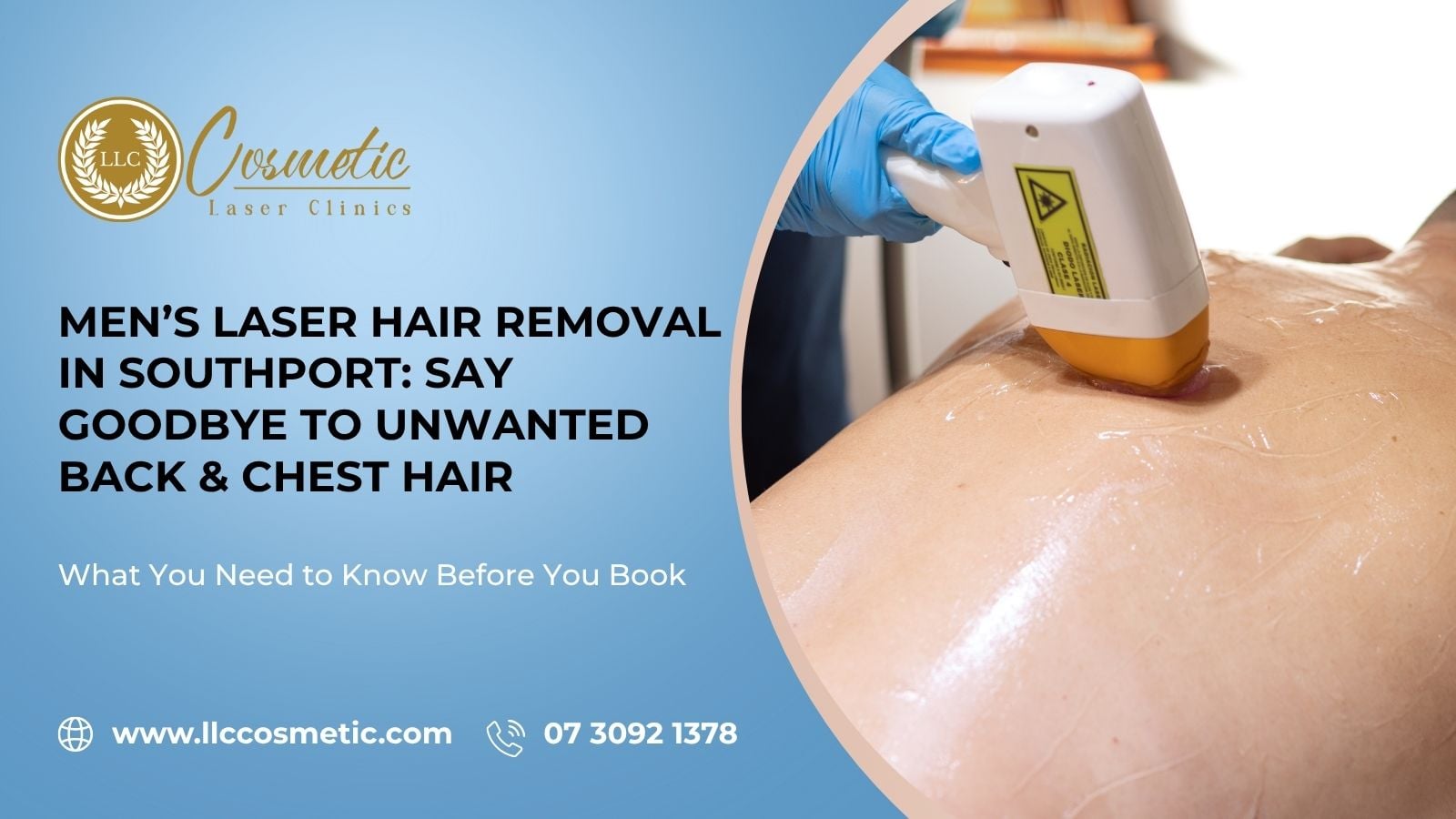 Men’s Laser Hair Removal in Southport: Say Goodbye to Unwanted Back & Chest Hair