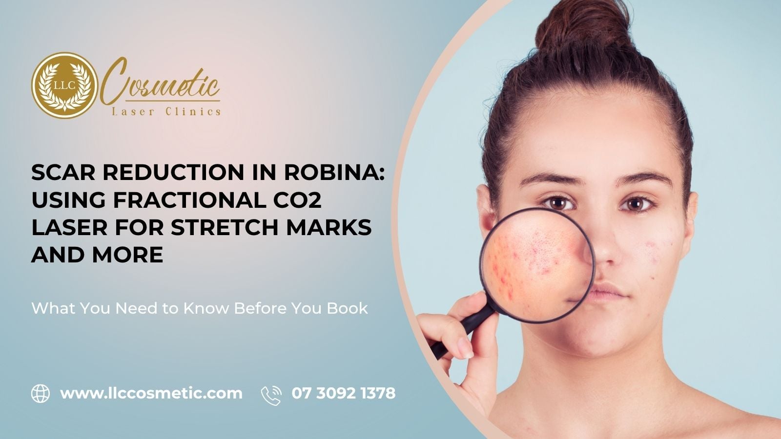 Scar Reduction Robina, Fractional CO2 Laser, Stretch Marks and More