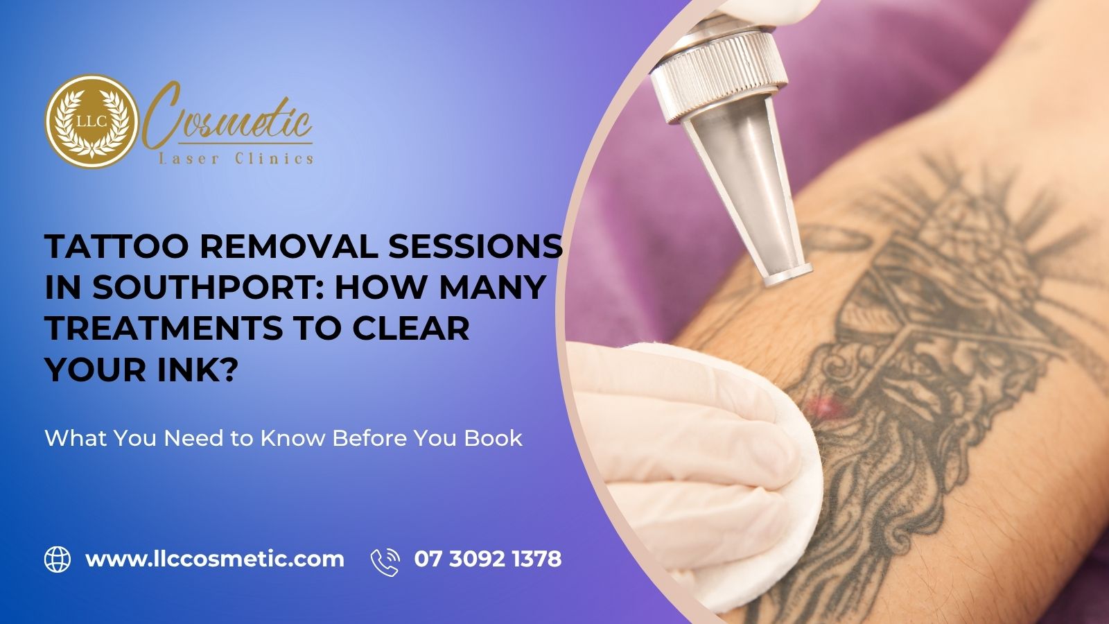Tattoo Removal Sessions, Southport, How Many Treatments, Clear Your Ink?