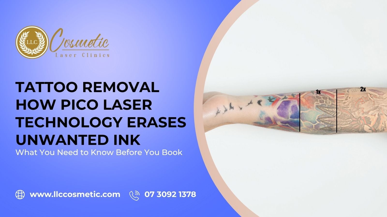 Tattoo Removal Robina Get Rid of Unwanted Ink, Pico Laser Technology