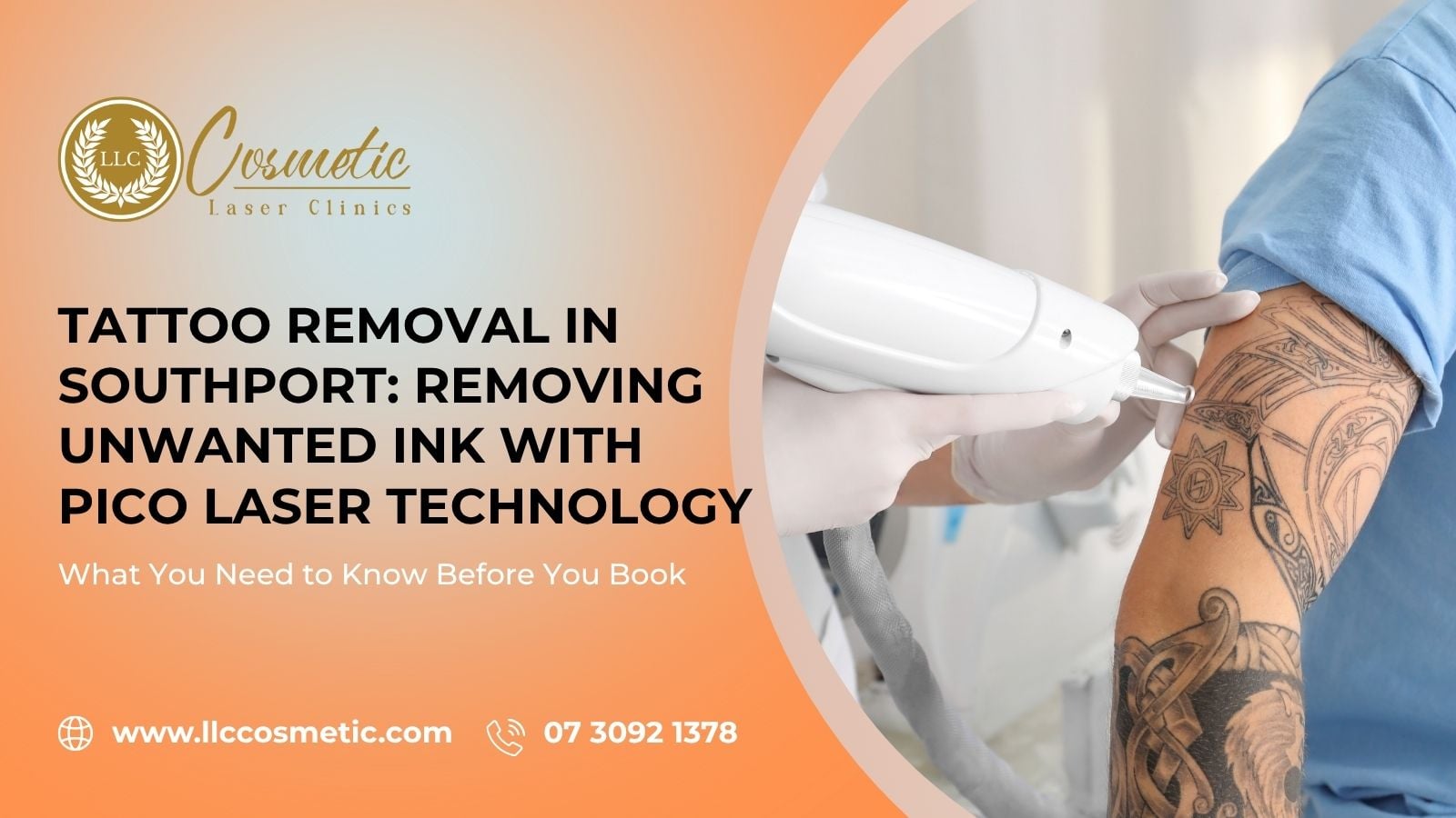 Tattoo Removal Southport Removing Unwanted Ink Pico Laser Technology