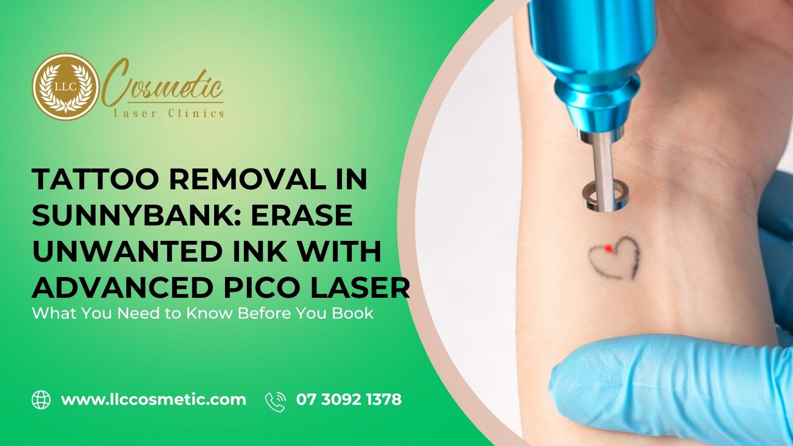 Tattoo Removal, Sunnybank, Erase Unwanted Ink Advanced Pico Laser