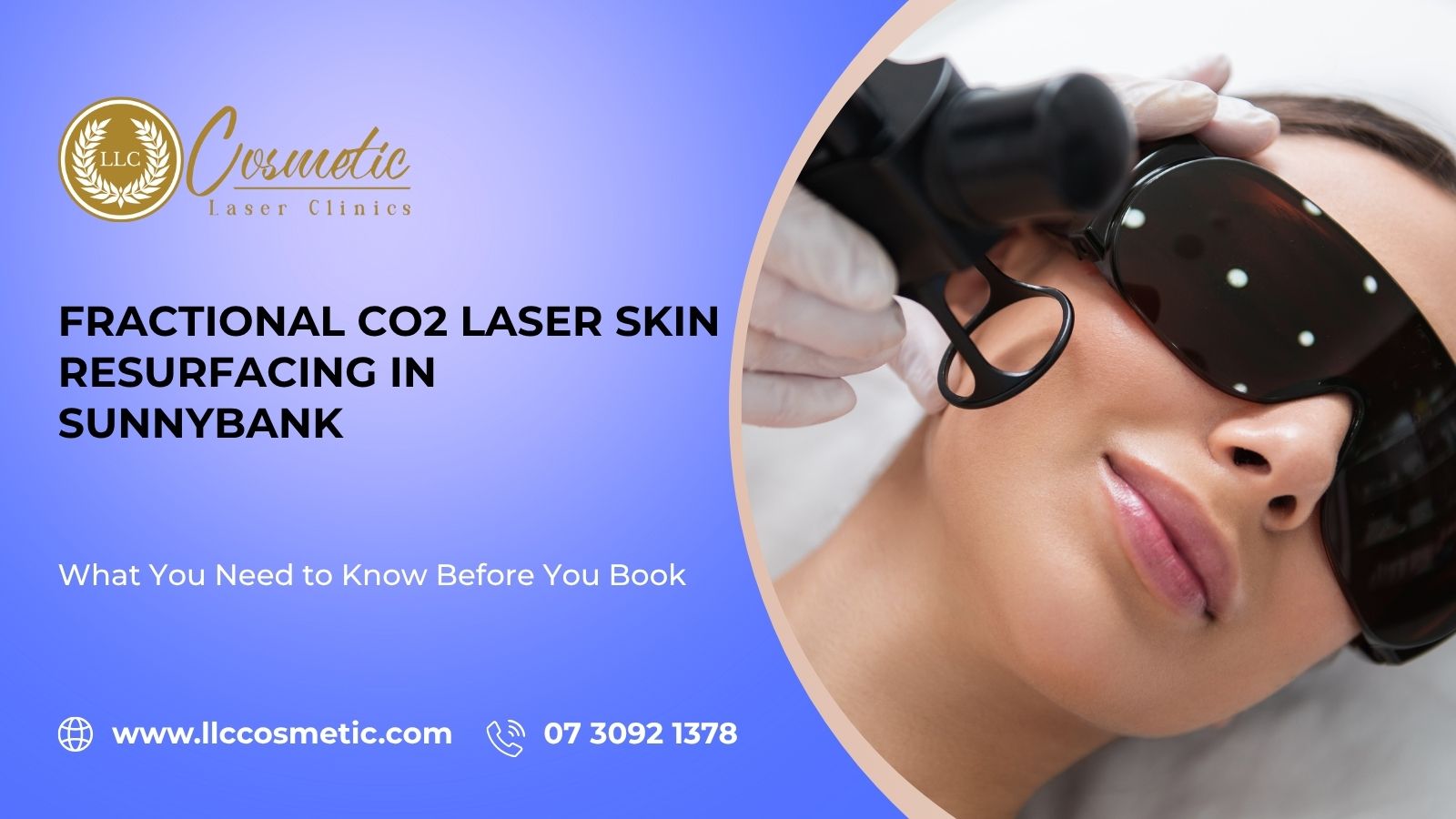 Fractional CO2 Laser Skin Resurfacing in Sunnybank – Transform Your Skin