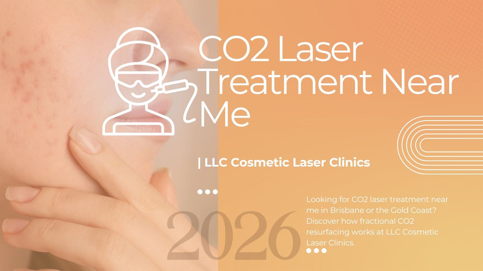 CO2 laser treatment near me — professional skin resurfacing at LLC Cosmetic Laser Clinics Brisbane and Gold Coast