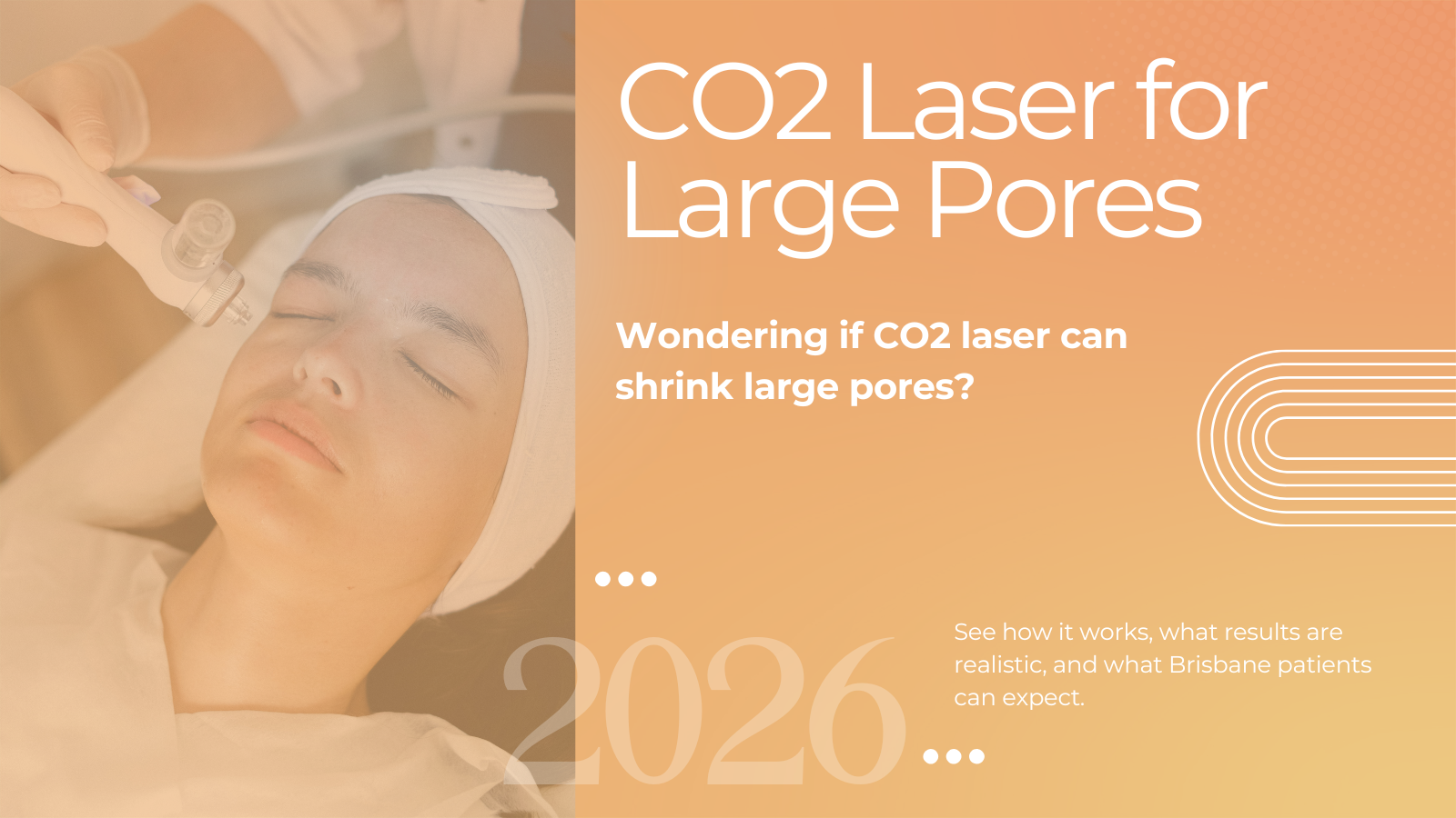 CO2 laser for large pores treatment at LLC Cosmetic Brisbane